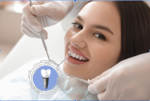 dental implants in the uk